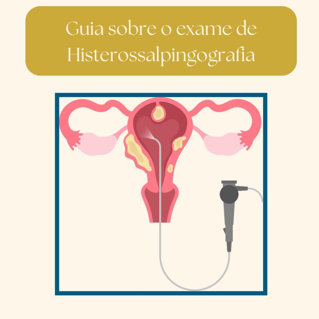 exame de Histerossalpingografia