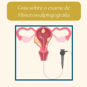 exame de Histerossalpingografia